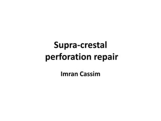 Supra-crestal
perforation repair
Imran Cassim

 