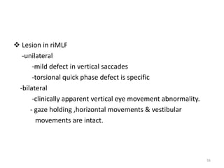  Lesion in riMLF
-unilateral
-mild defect in vertical saccades
-torsional quick phase defect is specific
-bilateral
-clinically apparent vertical eye movement abnormality.
- gaze holding ,horizontal movements & vestibular
movements are intact.
56
 