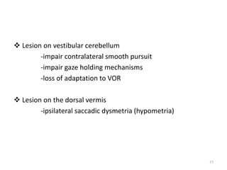  Lesion on vestibular cerebellum
-impair contralateral smooth pursuit
-impair gaze holding mechanisms
-loss of adaptation to VOR
 Lesion on the dorsal vermis
-ipsilateral saccadic dysmetria (hypometria)
77
 