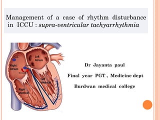 Management  of  a  case  of  rhythm  disturbance  in  ICCU :  supra-ventricular tachyarrhythmia  Dr  Jayanta  paul  Final  year  PGT ,  Medicine dept Burdwan  medical  college  