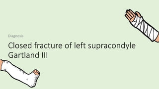 Closed fracture of left supracondyle
Gartland III
Diagnosis
 