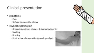 • Symptoms
• Pain
• Refusal to move the elbow
• Physical examination
• Gross deformity of elbow – S-shaped deformity
• Swelling
• Bruising
• Limit active elbow motion/pseudoparalysis
Clinical presentation
 