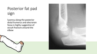 Posterior fat pad
sign
lucency along the posterior
distal humerus and olecranon
fossa is highly suggestive of
occult fracture around the
elbow
 