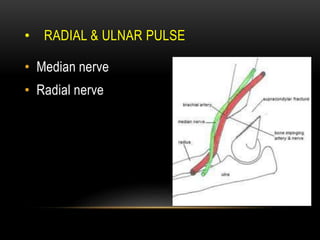 • RADIAL & ULNAR PULSE
• Median nerve
• Radial nerve
 