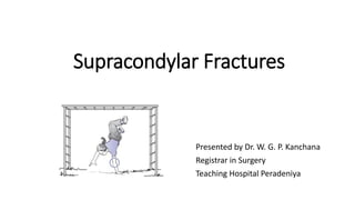 Supracondylar Fractures
Presented by Dr. W. G. P. Kanchana
Registrar in Surgery
Teaching Hospital Peradeniya
 