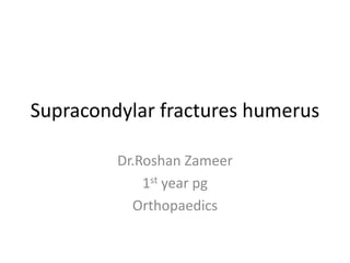 Supracondylar fractures humerus
Dr.Roshan Zameer
1st year pg
Orthopaedics
 