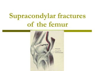 Supracondylar fractures of the femur 