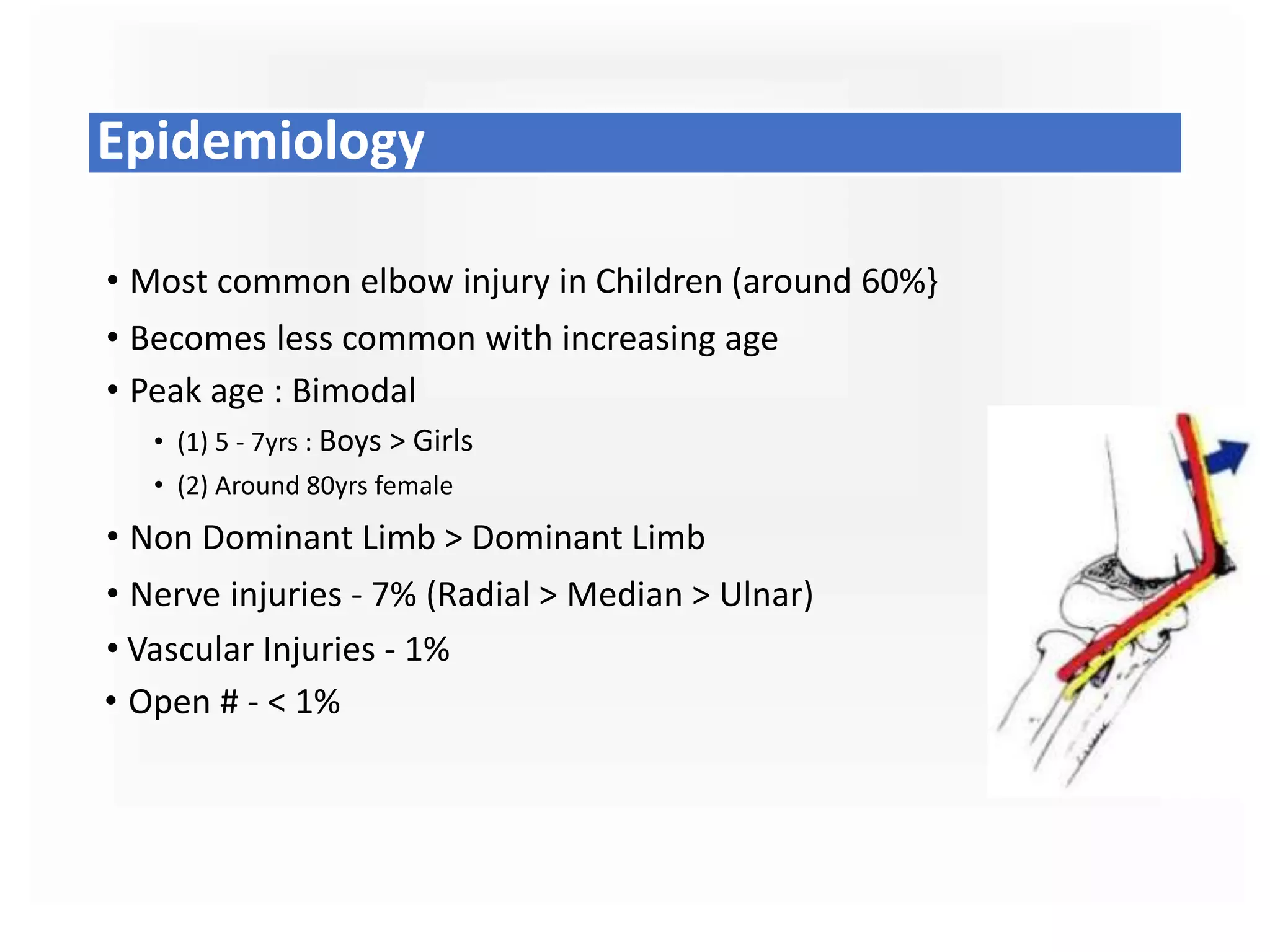 Epidemiology
• Most common elbow injury in Children (around 60%}
• Becomes less common with increasing age
• Peak age : Bimodal
• (1) 5 - 7yrs : Boys > Girls
• (2) Around 80yrs female
• Non Dominant Limb > Dominant Limb
• Nerve injuries - 7% (Radial > Median > Ulnar)
• Vascular Injuries - 1%
• Open # - < 1%
 