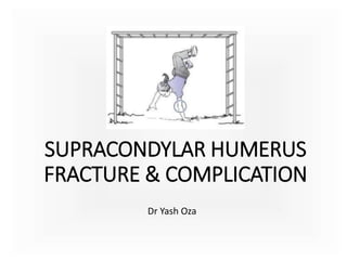 SUPRACONDYLAR HUMERUS
FRACTURE & COMPLICATION
Dr Yash Oza
 