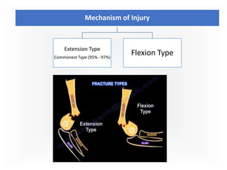 Supracondylar humerus fracture & complication for MBBS students | PPTX