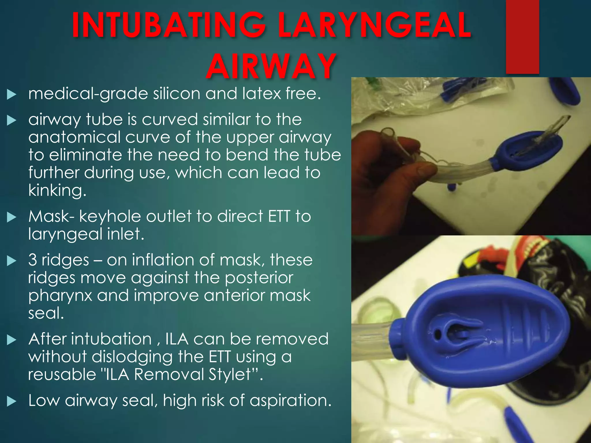 INTUBATING LARYNGEAL
AIRWAY
 medical-grade silicon and latex free.
 airway tube is curved similar to the
anatomical curve of the upper airway
to eliminate the need to bend the tube
further during use, which can lead to
kinking.
 Mask- keyhole outlet to direct ETT to
laryngeal inlet.
 3 ridges – on inflation of mask, these
ridges move against the posterior
pharynx and improve anterior mask
seal.
 After intubation , ILA can be removed
without dislodging the ETT using a
reusable "ILA Removal Stylet”.
 Low airway seal, high risk of aspiration.
 