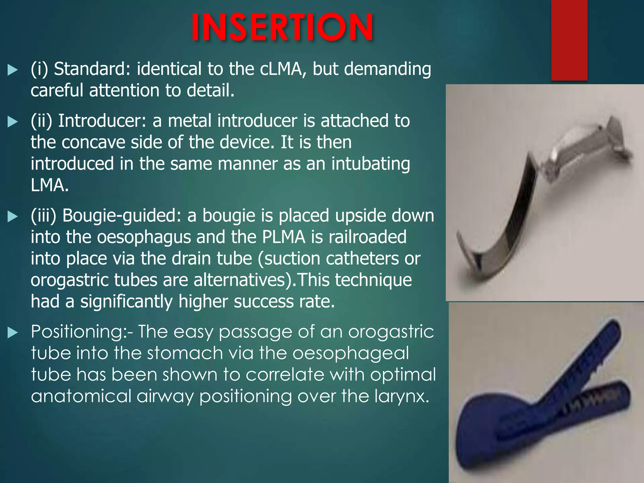 INSERTION
 (i) Standard: identical to the cLMA, but demanding
careful attention to detail.
 (ii) Introducer: a metal introducer is attached to
the concave side of the device. It is then
introduced in the same manner as an intubating
LMA.
 (iii) Bougie-guided: a bougie is placed upside down
into the oesophagus and the PLMA is railroaded
into place via the drain tube (suction catheters or
orogastric tubes are alternatives).This technique
had a significantly higher success rate.
 Positioning:- The easy passage of an orogastric
tube into the stomach via the oesophageal
tube has been shown to correlate with optimal
anatomical airway positioning over the larynx.
 