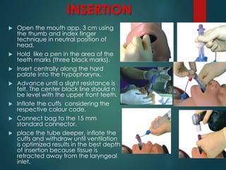 INSERTION
 Open the mouth app. 3 cm using
the thumb and index finger
technique in neutral position of
head.
 Hold like a pen in the area of the
teeth marks (three black marks).
 Insert centrally along the hard
palate into the hypopharynx.
 Advance until a slight resistance is
felt. The center black line should n
be level with the upper front teeth.
 Inflate the cuffs considering the
respective colour code.
 Connect bag to the 15 mm
standard connector.
 place the tube deeper, inflate the
cuffs and withdraw until ventilation
is optimized results in the best depth
of insertion because tissue is
retracted away from the laryngeal
inlet.
 