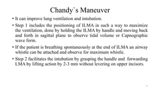 Chandy`s Maneuver
• It can improve lung ventilation and intubation.
• Step 1 includes the positioning of ILMA in such a way to maximize
the ventilation, done by holding the ILMA by handle and moving back
and forth in sagittal plane to observe tidal volume or Capnographic
wave form.
• If the patient is breathing spontaneously at the end of ILMA an airway
whistle can be attached and observe for maximum whistle.
• Step 2 facilitates the intubation by grasping the handle and forwarding
LMA by lifting action by 2-3 mm without levering on upper incisors.
27
 