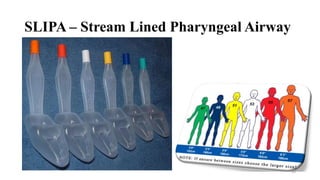 SLIPA – Stream Lined Pharyngeal Airway
35
 