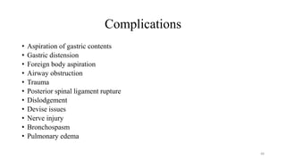 Complications
• Aspiration of gastric contents
• Gastric distension
• Foreign body aspiration
• Airway obstruction
• Trauma
• Posterior spinal ligament rupture
• Dislodgement
• Devise issues
• Nerve injury
• Bronchospasm
• Pulmonary edema
48
 
