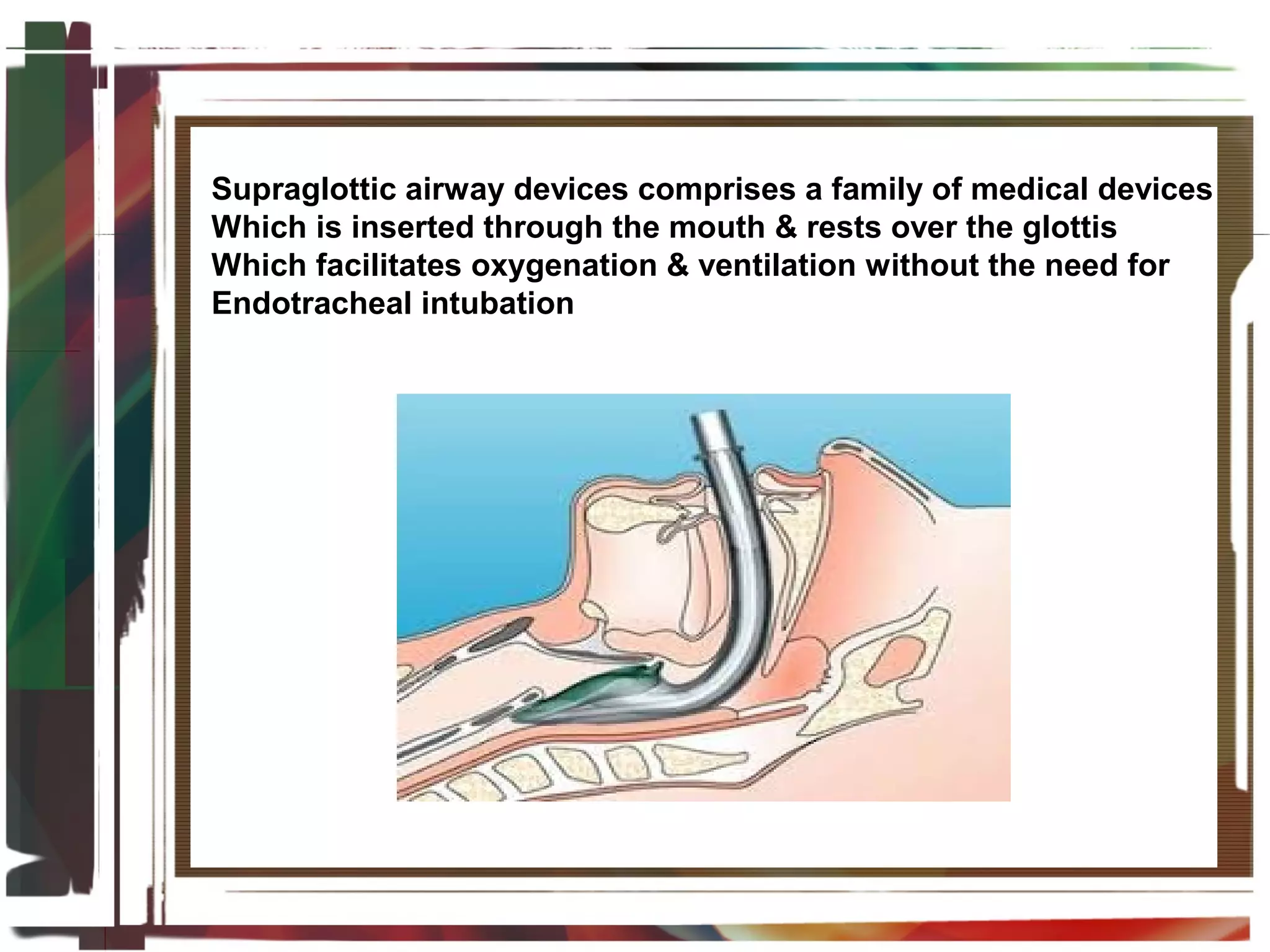 Future Directions in Emergency Airway Care
