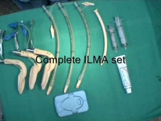 Supraglottic airway devices | PPTX