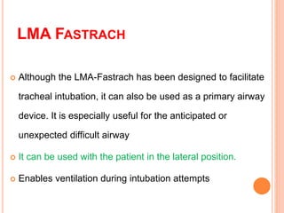 LMA® Fastrach™ Reusable Airway - Size 3, Supraglottic Airways, Airway, Anesthesia