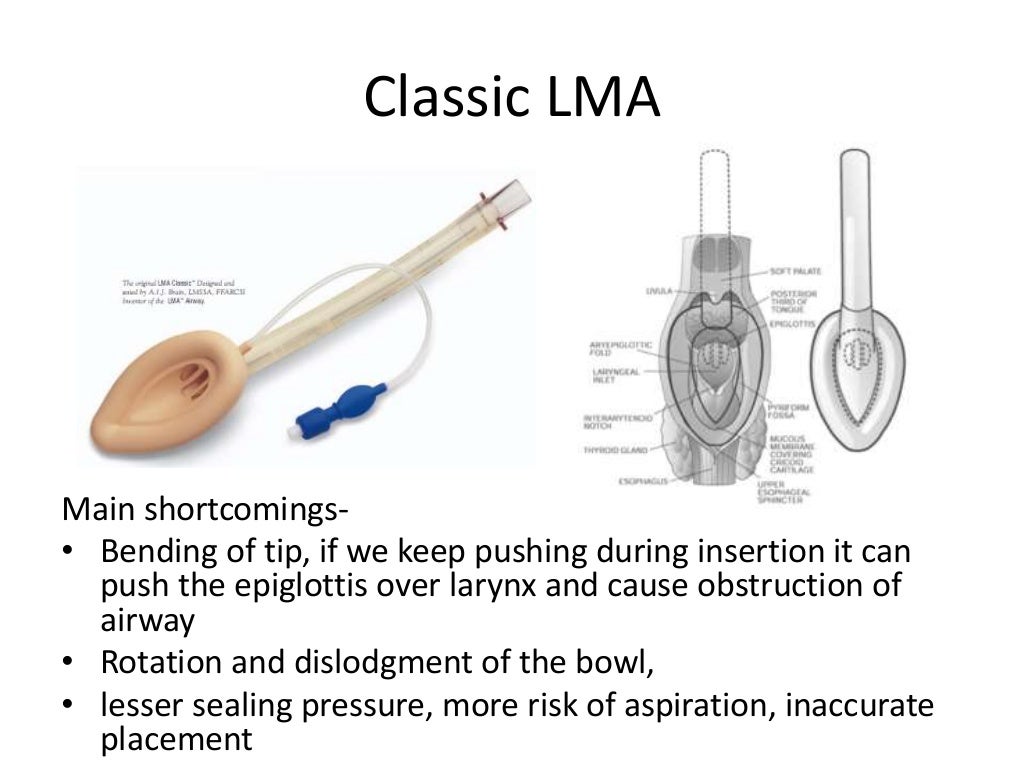 Supraglottic airways