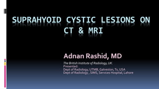 SUPRAHYOID CYSTIC LESIONS ON
CT & MRI
Adnan Rashid, MD
The British Institute of Radiology,UK.
Presented:
Dept of Radiology, UTMB,Galveston,Tx, USA
Dept of Radiology , SIMS, Services Hospital, Lahore
 