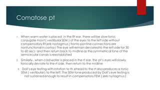 Comatose pt
1. When warm water is placed in the Rt ear, there will be slow tonic
conjugate movt ( vestibular SEM ) of the eyes to the left side without
compensatory Rt jerk nystagmus ( fronto pontine connections are
nonfunctional in coma) The eye will remain deviatedto the left side for 30
to 60 secs and then return back to midlineas the symmetrical tone of the
semicircular canals is reestablished
2. Similarly , when cold water is placed in the rt ear, the pt’s eyes will slowly,
tonically deviate to the rt side, then return to the midline
3. Doll’s eye testing with rotation to th ehead to the rt also produces a tonic
SEM ( vestibular ) to the left. The SEM tone produced by Doll’s eye testing is
not sustainedenough to result in compensatory FEM ( jerk nystagmus )
 
