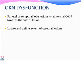 OKN DYSFUNCTION
 Parietal or temporal lobe lesions -> abnormal OKN
towards the side of lesion
 Locate and define extent of cerebral lesions
 