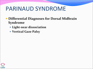 PARINAUD SYNDROME
 Differential Diagnoses for Dorsal Midbrain
Syndrome
 Light-near dissociation
 Vertical Gaze Palsy
 