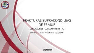 FRACTURAS SUPRACONDILEAS
DE FEMUR
CESAR ADRIEL FLORES ORTIZ R2 TYO
HOSPITAL GENERAL REGIONAL N° 1 CULIACAN
 