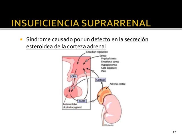 Resultado de imagen de tratamiento de alteraciones en corteza suprarrenal