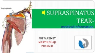 PREPARED BY
MARTIN SHAJI
PHARM D
🔈 SUPRASPINATUS
TEAR-
medical information.
 