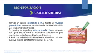 MONITORIZACIÓN
• Permite un estricto control de la PA y facilita las muestras
gasométricas, necesarias para evaluar la correcta ventilación
y el estado hidroelectrolítico.
• Su canalización se prefiere antes de la inducción en pacientes
con gran efecto masa o importante comorbilidad para
monitorizar mejor los cambios hemodinámicos.
• El traductor debe colocarse idealmente a nivel del conducto
auditivo externo para facilitar el cálculo de la PPC.
Rodríguez Contreras R. Anestesia en tumores supratentoriales. parte I [Internet]. AnestesiaR. 2022 [cited 2023Apr2]. Available from: https://anestesiar.org/2022/anestesia-en-
tumores-supratentoriales-parte-i/
CATÉTER ARTERIAL
 