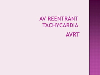 AV REENTRANT
TACHYCARDIA

 