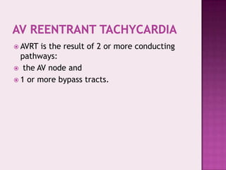  AVRT

is the result of 2 or more conducting
pathways:
 the AV node and
 1 or more bypass tracts.

 