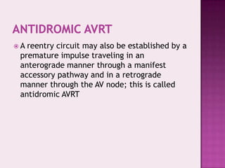 A

reentry circuit may also be established by a
premature impulse traveling in an
anterograde manner through a manifest
accessory pathway and in a retrograde
manner through the AV node; this is called
antidromic AVRT

 
