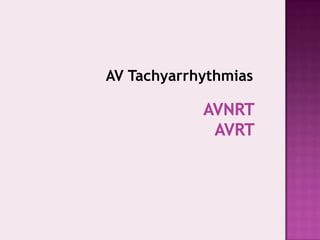 AV Tachyarrhythmias

 