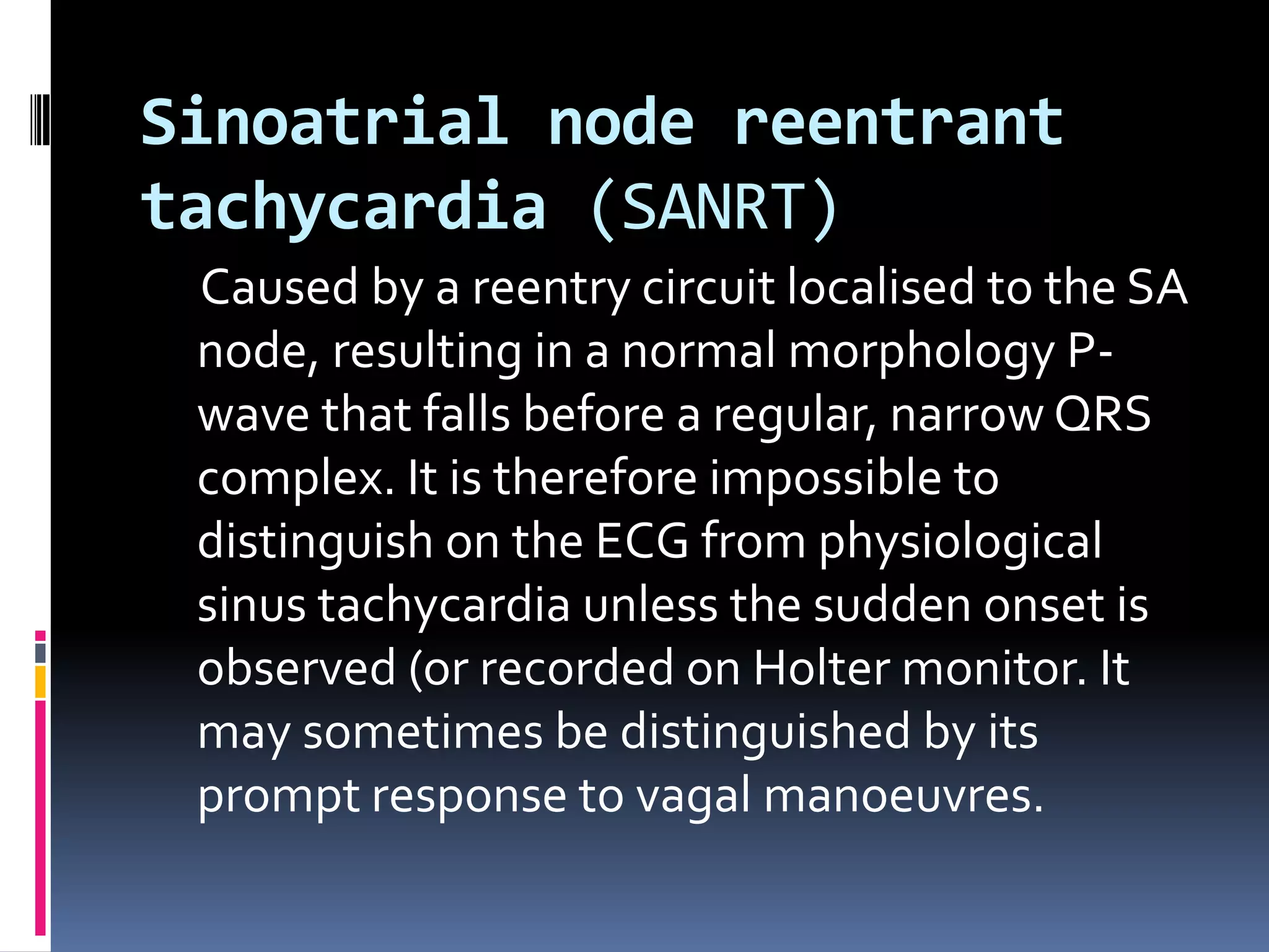 Supraventricular tachyarrythmias | PPTX