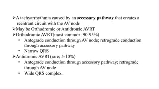 A tachyarrhythmia caused by an accessary pathway that creates a
reentrant circuit with the AV node
May be Orthodromic or Antidromic AVRT
Orthodromic AVRT(most common; 90-95%)
• Antegrade conduction through AV node; retrograde conduction
through accessory pathway
• Narrow QRS
Antidromic AVRT(rare; 5-10%)
• Antegrade conduction through accessory pathway; retrograde
through AV node
• Wide QRS complex
 
