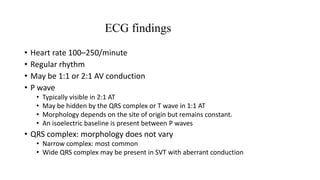 ECG findings
• Heart rate 100–250/minute
• Regular rhythm
• May be 1:1 or 2:1 AV conduction
• P wave
• Typically visible in 2:1 AT
• May be hidden by the QRS complex or T wave in 1:1 AT
• Morphology depends on the site of origin but remains constant.
• An isoelectric baseline is present between P waves
• QRS complex: morphology does not vary
• Narrow complex: most common
• Wide QRS complex may be present in SVT with aberrant conduction
 
