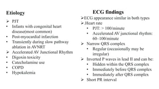  PJT
• Infants with congenital heart
disease(most common)
• Post-myocardial infarction
• Transiently during slow pathway
ablation in AVNRT
 Accelerated AV Junctional Rhythm
• Digoxin toxicity
• Catecholamine use
• COPD
• Hypokalemia
Etiology
ECG appearance similar in both types
.Heart rate
• PJT: > 100/minute
• Accelerated AV junctional rhythm:
60–100/minute
 Narrow QRS complex
• Regular (occasionally may be
irregular)
 Inverted P waves in lead II and can be:
• Hidden within the QRS complex
• Immediately before QRS complex
• Immediately after QRS complex
 Short PR interval
ECG findings
 