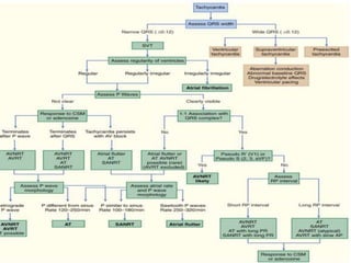 Supraventricular tachycardias | PPTX