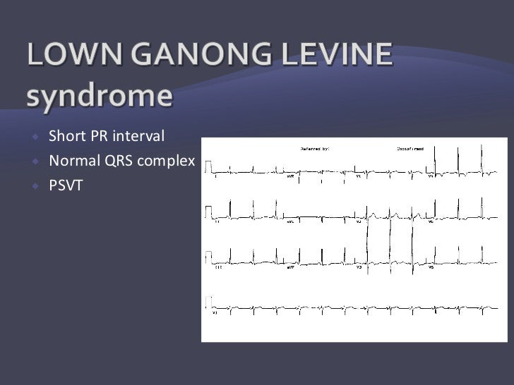 Supraventricular tachycardias