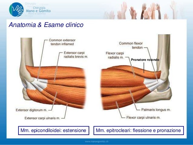 il-gomito-patologie-muscolo-tendinee-1-parte-21112013