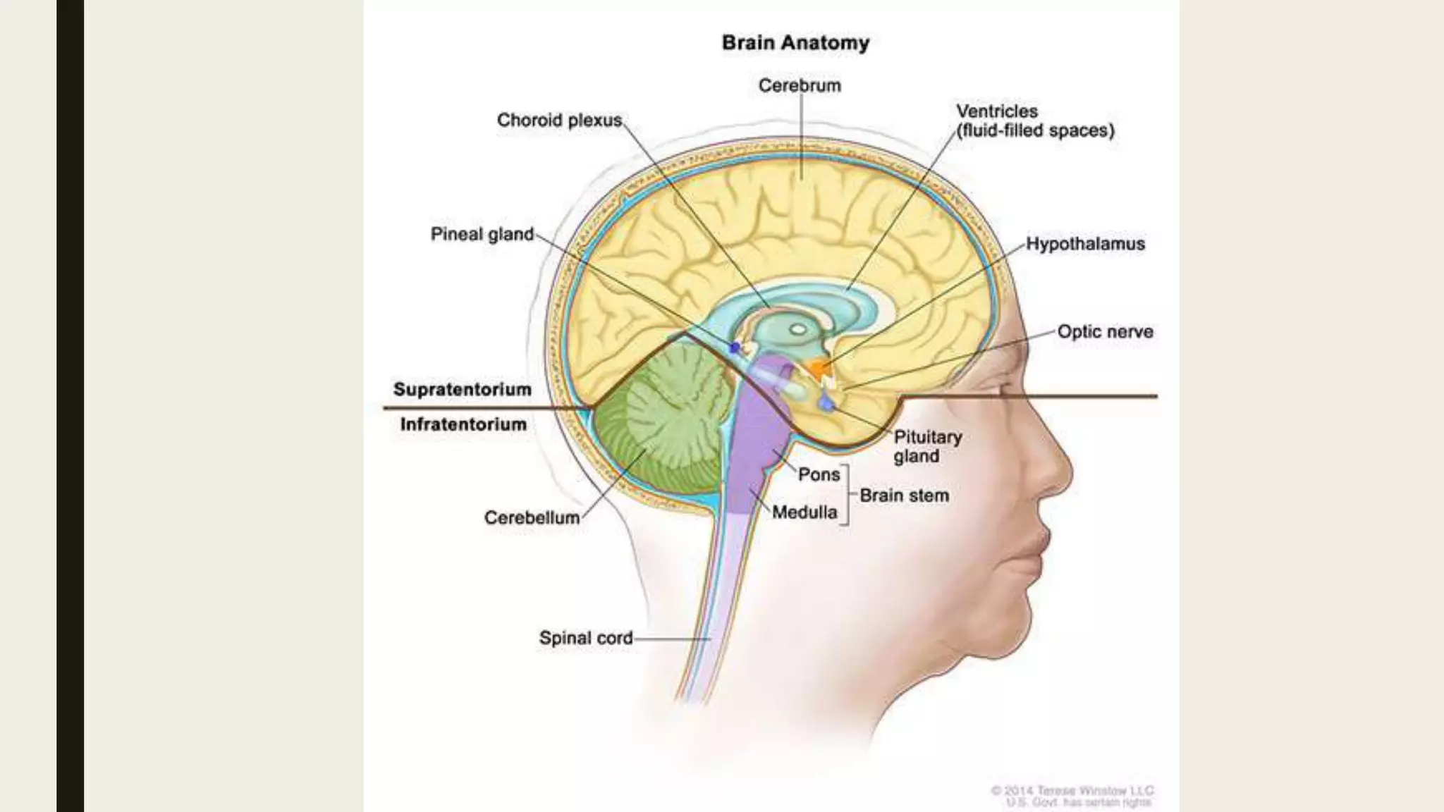 Supratentorial brain tumours | PPT