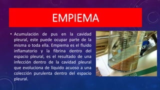 EMPIEMA
• Acumulación de pus en la cavidad
pleural, este puede ocupar parte de la
misma o toda ella. Empiema es el fluido
inflamatorio y la fibrina dentro del
espacio pleural, es el resultado de una
infección dentro de la cavidad pleural
que evoluciona de líquido acuoso a una
colección purulenta dentro del espacio
pleural.
 