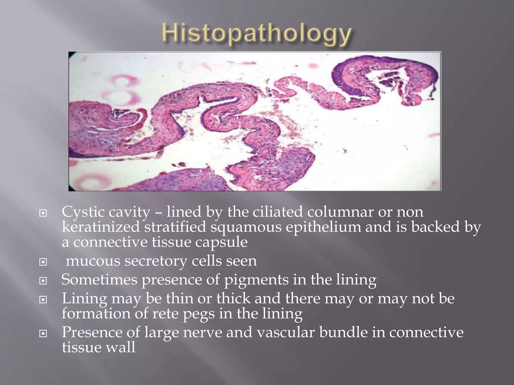  Cystic cavity – lined by the ciliated columnar or non
keratinized stratified squamous epithelium and is backed by
a connective tissue capsule
 mucous secretory cells seen
 Sometimes presence of pigments in the lining
 Lining may be thin or thick and there may or may not be
formation of rete pegs in the lining
 Presence of large nerve and vascular bundle in connective
tissue wall
 