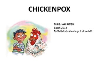 CHICKENPOX
SURAJ AHIRWAR
Batch 2013
MGM Medical college Indore MP
 