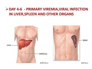 DAY 4-6 - PRIMARY VIREMIA,VIRAL INFECTION
IN LIVER,SPLEEN AND OTHER ORGANS
 