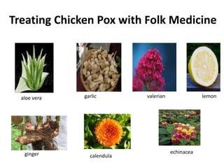 garlic lemonvalerianaloe vera
calendula
echinaceaginger
Treating Chicken Pox with Folk Medicine
 
