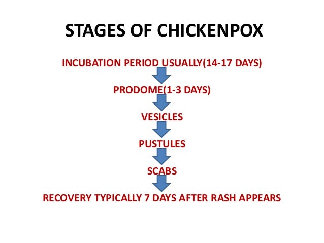Chicken Pox Chart